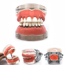 Load image into Gallery viewer, Adult Pathological Periodontal disease #4017 Oral Education Dental Study Teeth Model