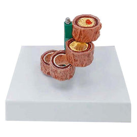 Blood Vessel  human Hardening Of The Arteries Arteriosclerosis Model human Anatomical  anatomy Model Medical supplies tools